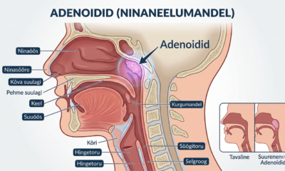 Adenoidid