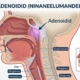 Adenoidid