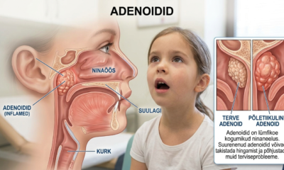 Adenoidid