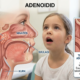 Adenoidid